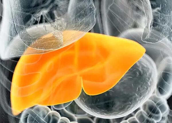 exs-lvr-WebinarImage-03